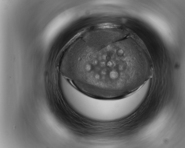 X0000098171438200805011003