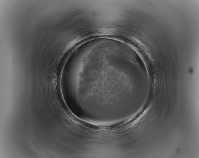 X0000098171449200805011002