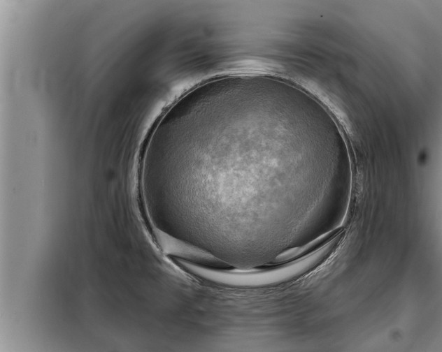 X0000098171477200805011002