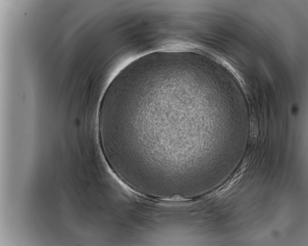 X0000098171487200805011002