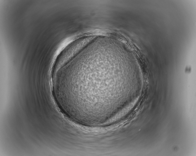 X0000098170006200805081011