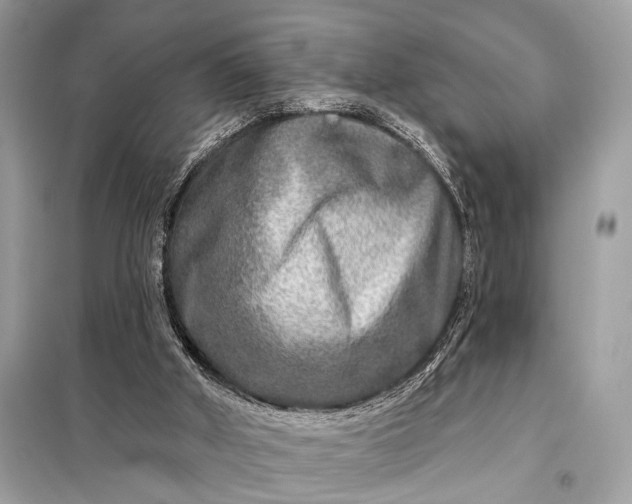 X0000098170010200805081011