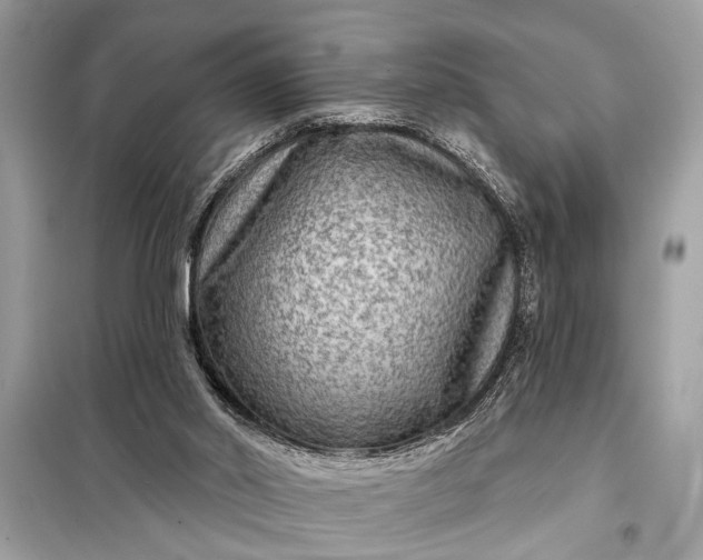 X0000098170014200805081011