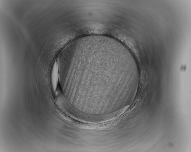 X0000098170017200805081011