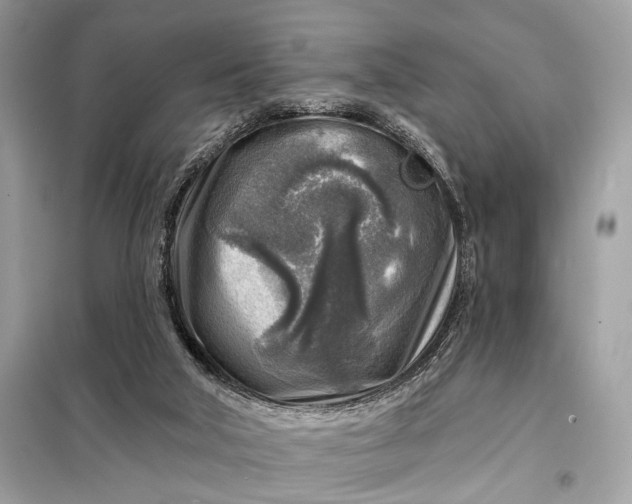 X0000098170018200805081011