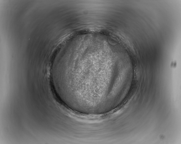 X0000098170032200805081011