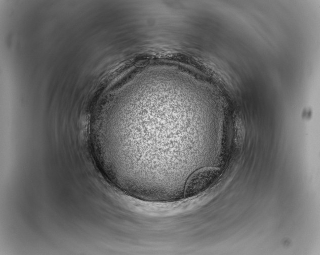 X0000098170034200805081011