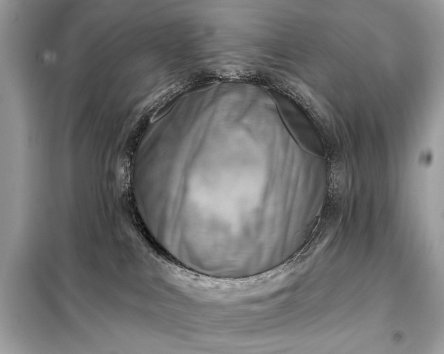 X0000098170043200805081011