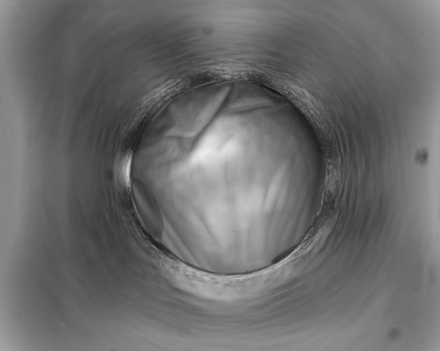 X0000098170047200805081011