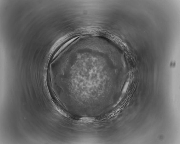 X0000098170051200805081010