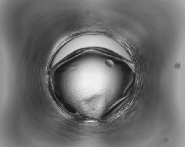 X0000098170053200805081010