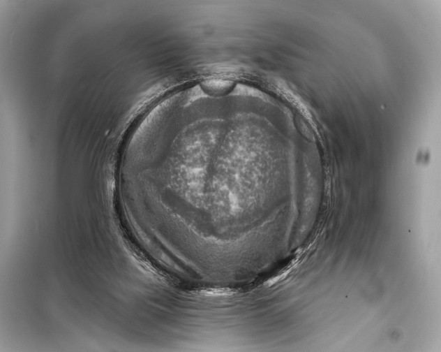 X0000098170059200805081010