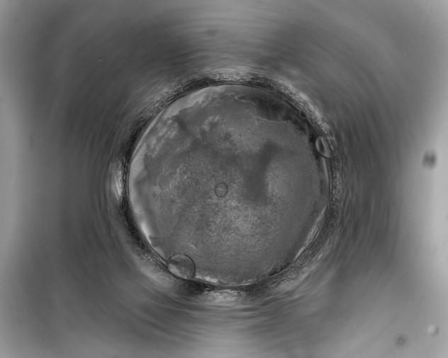 X0000098170069200805081010