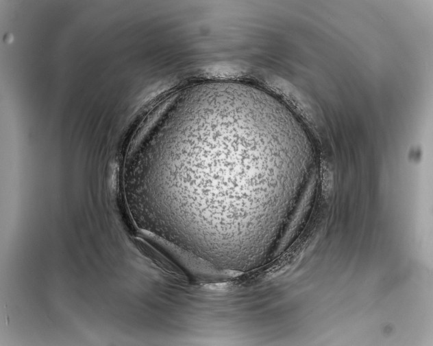 X0000098170071200805081010