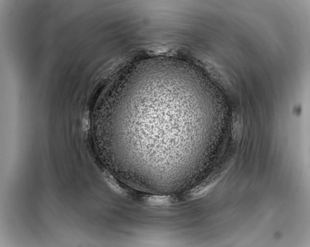 X0000098170085200805081011