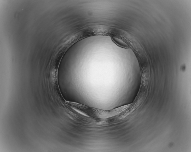 X0000098170093200805081011