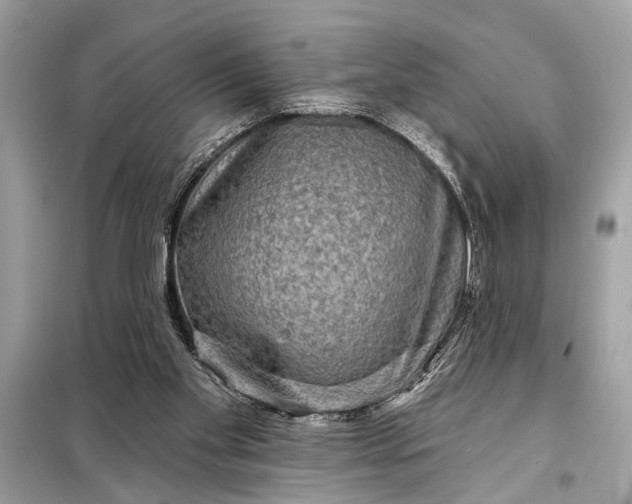 X0000098170109200805081010