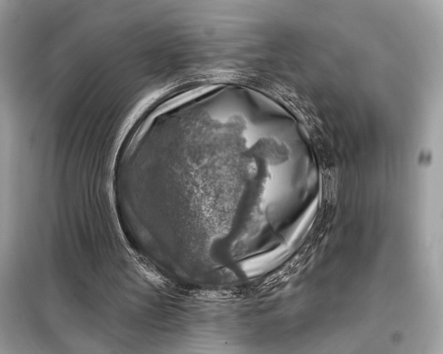 X0000098170147200805081009