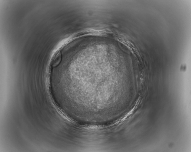 X0000098170149200805081009