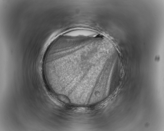 X0000098170151200805081009