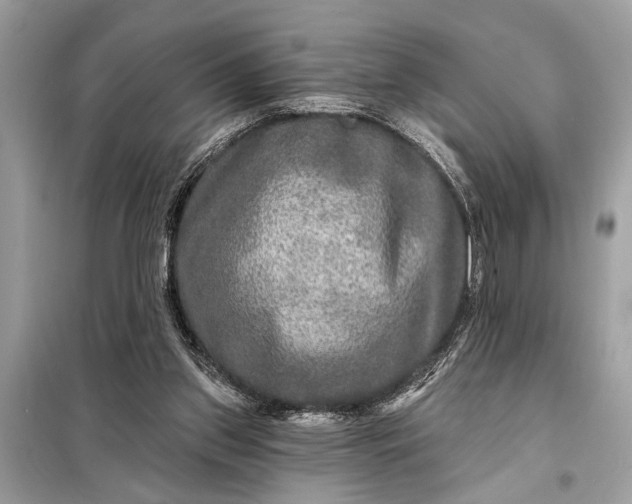 X0000098170157200805081009