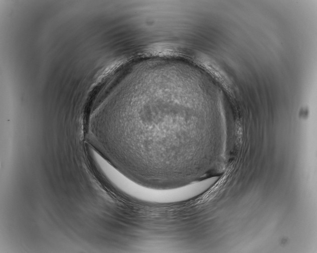 X0000098170158200805081009