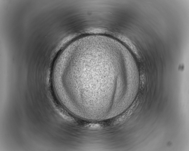 X0000098170159200805081009