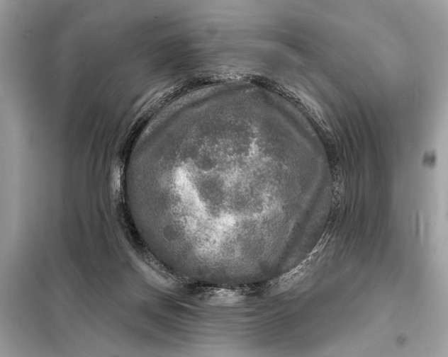 X0000098170166200805081009