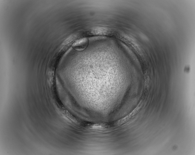 X0000098170171200805081009