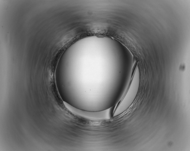 X0000098170176200805081009