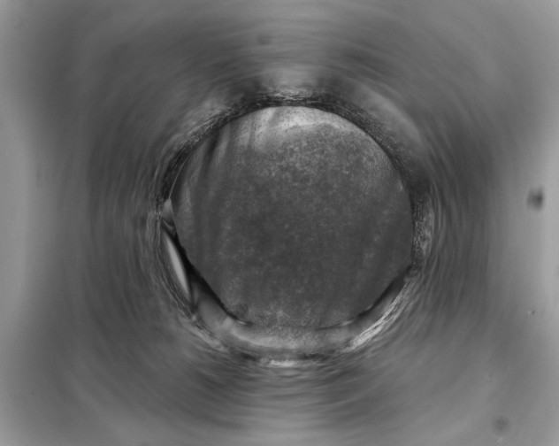 X0000098170180200805081009