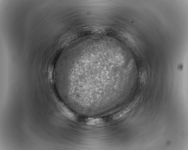 X0000098170185200805081009