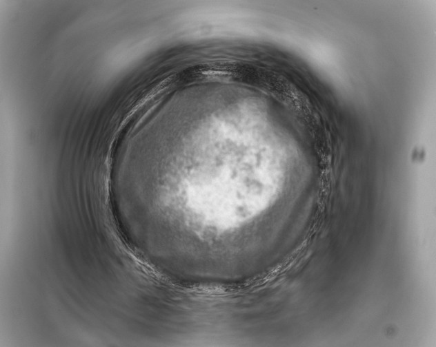 X0000098170194200805081009