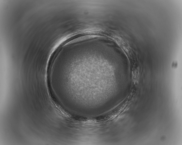 X0000098170196200805081009