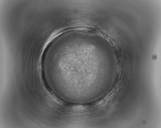 X0000098170198200805081009