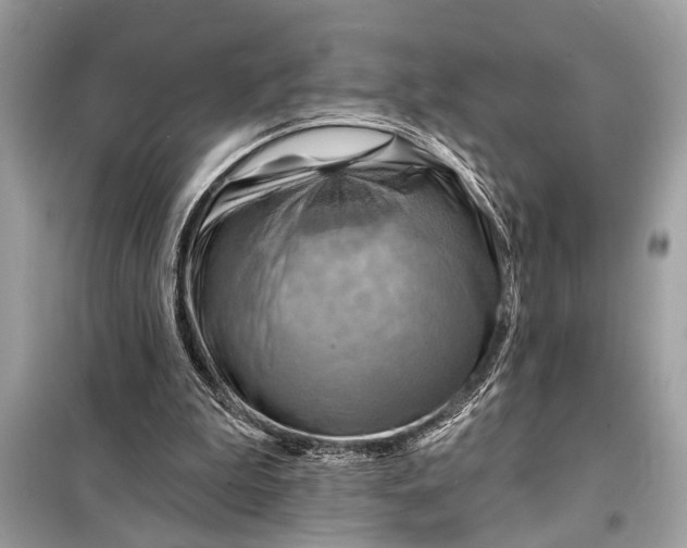 X0000098170199200805081009