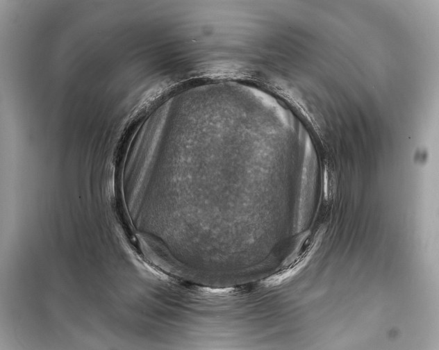 X0000098170205200805081009