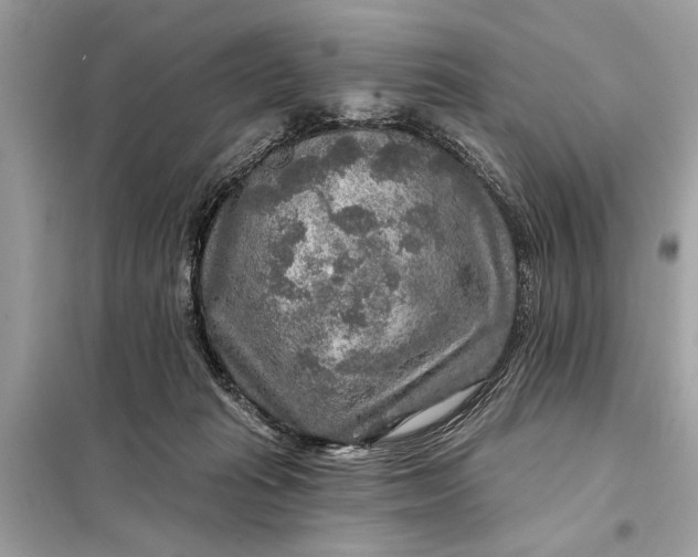 X0000098170269200805081008