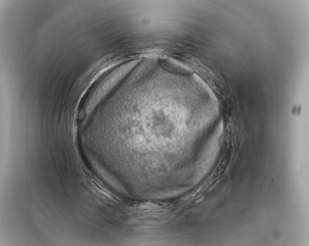 X0000098170290200805081007