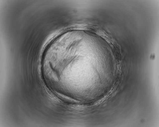 X0000098170293200805081007