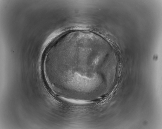 X0000098170296200805081007