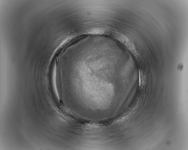 X0000098170300200805081007