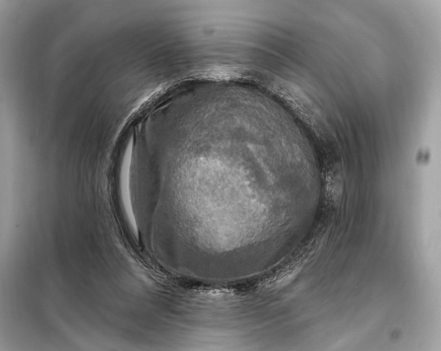 X0000098170304200805081007