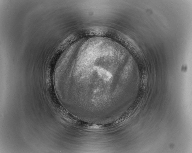 X0000098170312200805081007