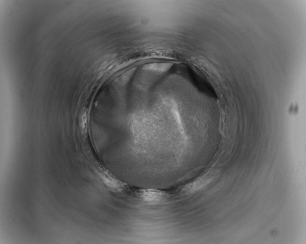 X0000098170336200805081007