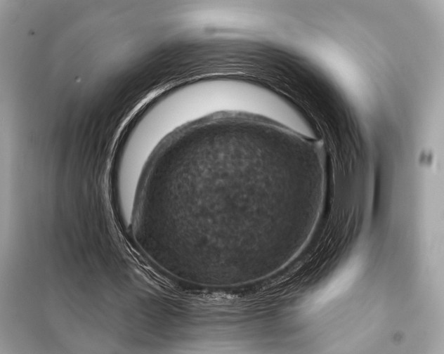 X0000098170387200805081006