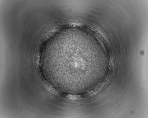 X0000098170417200805081005