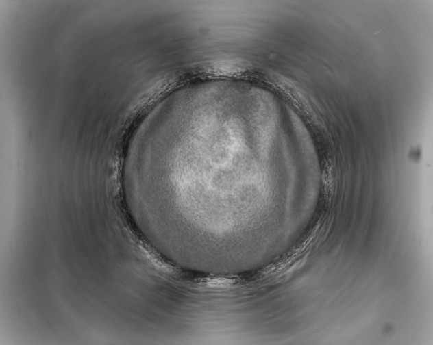 X0000098170462200805081005