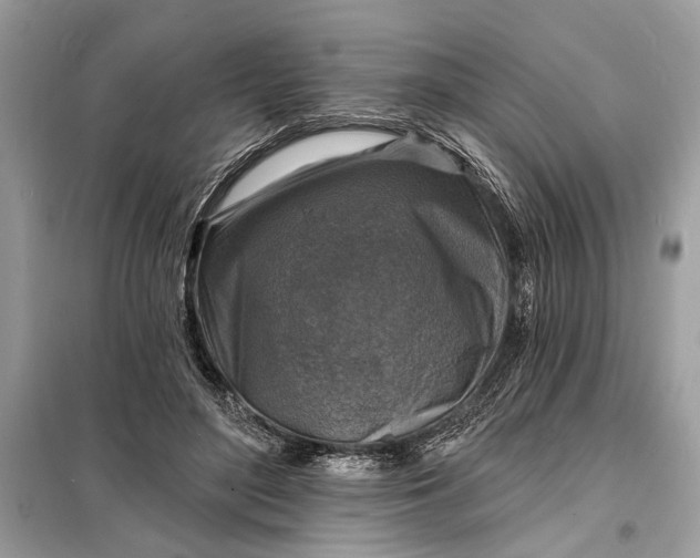 X0000098170500200805081004