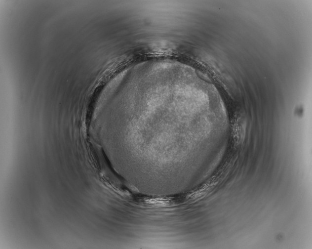 X0000098170516200805081004